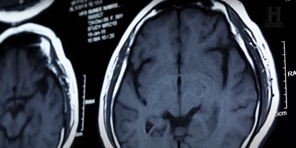 Depresión: 12 síntomas que podrían evidenciar la presencia de este cuadro 2 Depresion otra